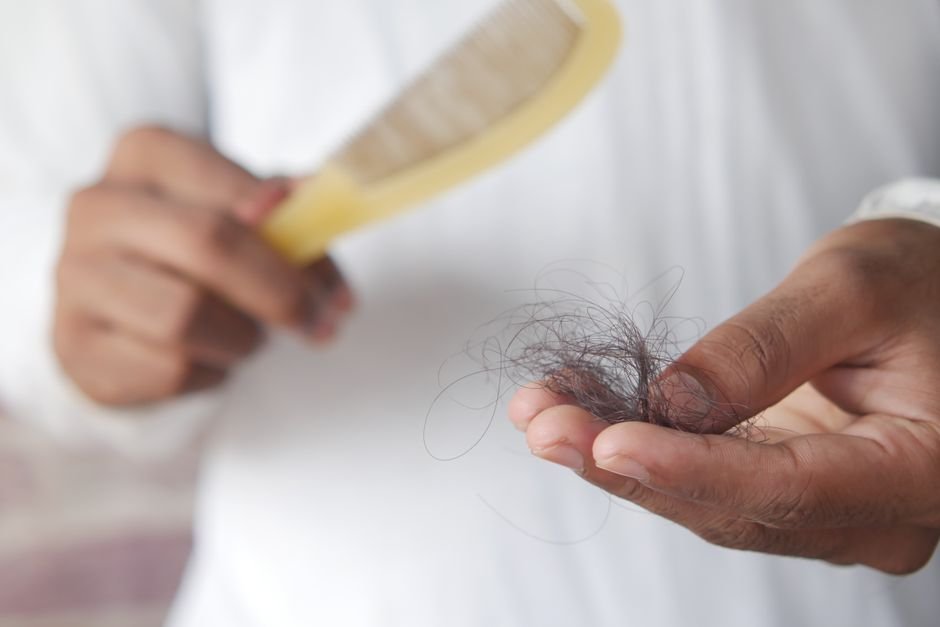 Hair Replacement (PRP)